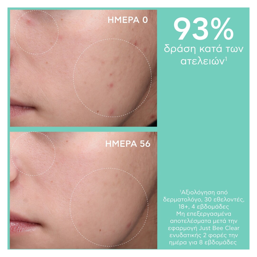 JUST BEE CLEAR ΣΕΤ ΚΑΤΑ ΤΩΝ ΑΤΕΛΕΙΩΝ ΕΝΥΔΑΤΩΣΗ & ΜΑΤ ΑΠΟΤΕΛΕΣΜΑ  5