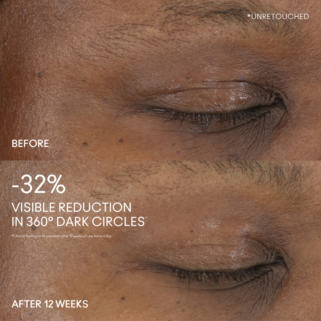 HYPER REAL SERUMIZER™ EYE  2