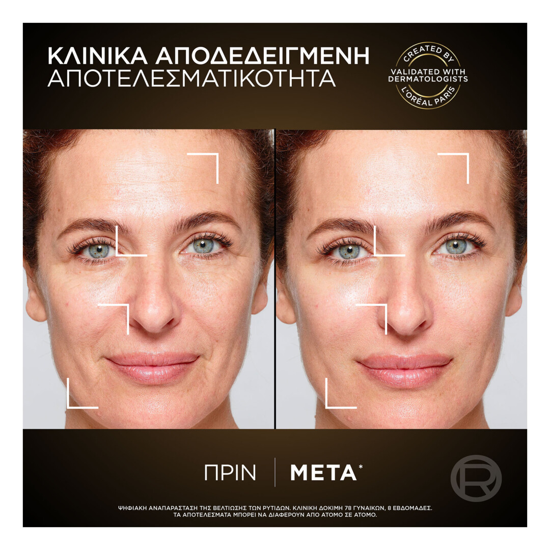AGE PERFECT ΚΥΤΤΑΡΙΚΗ ΑΝΑΠΛΑΣΗ ΚΡΕΜΑ ΝΥΚΤΟΣ MIDNIGHT 3