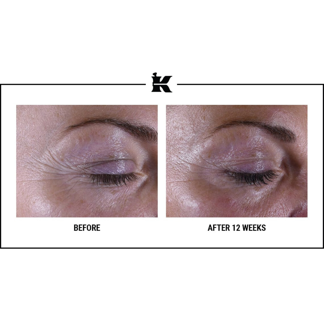 SUPER MULTI-CORRECTIVE EYE ZONE TREATMENT 16