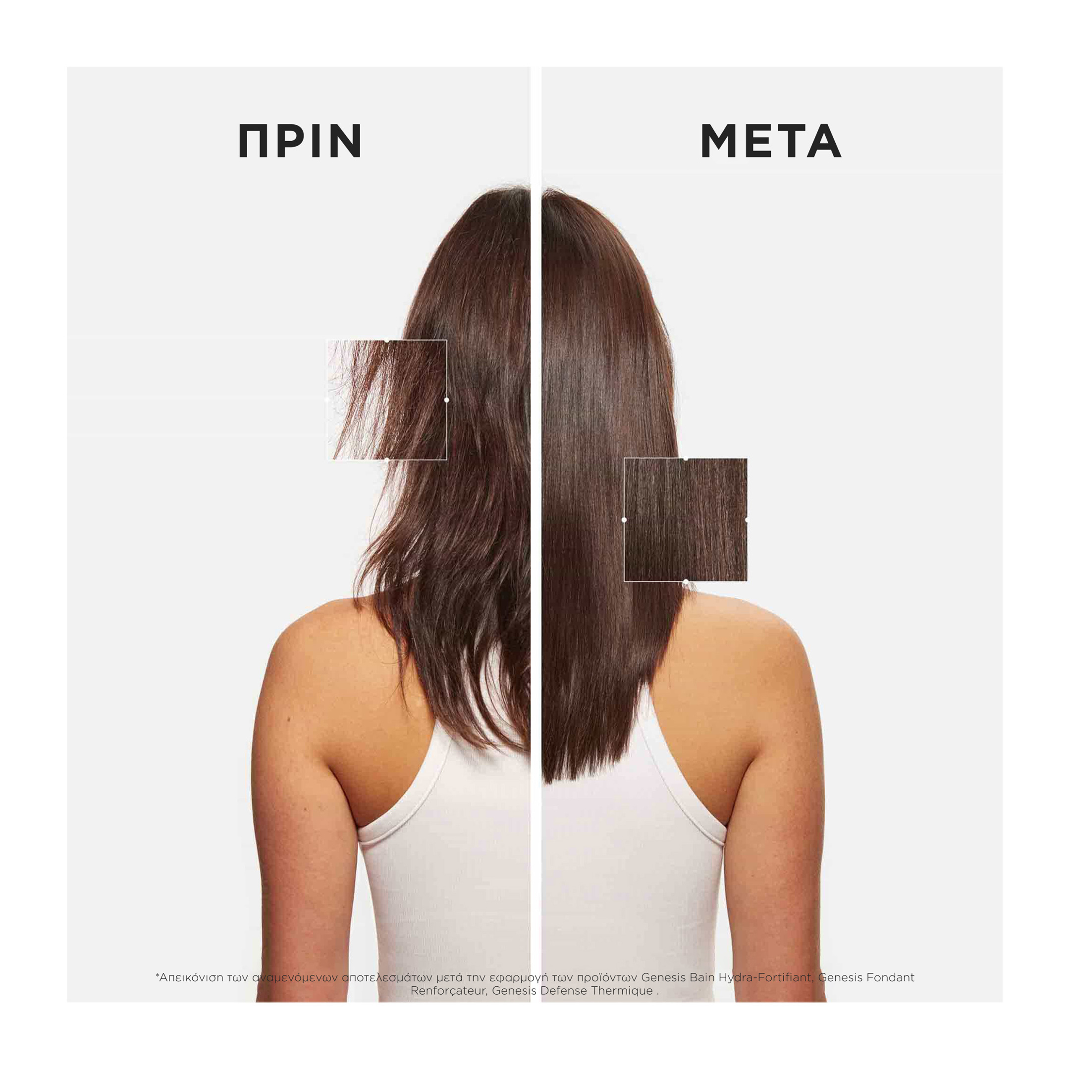 GENESIS ΣΕΤ ΠΕΡΙΠΟΙΗΣΗΣ ΓΙΑ ΑΔΥΝΑΜΑ ΜΑΛΛΙΑ ΜΕ ΤΑΣΗ ΤΡΙΧΟΠΤΩΣΗΣ 4