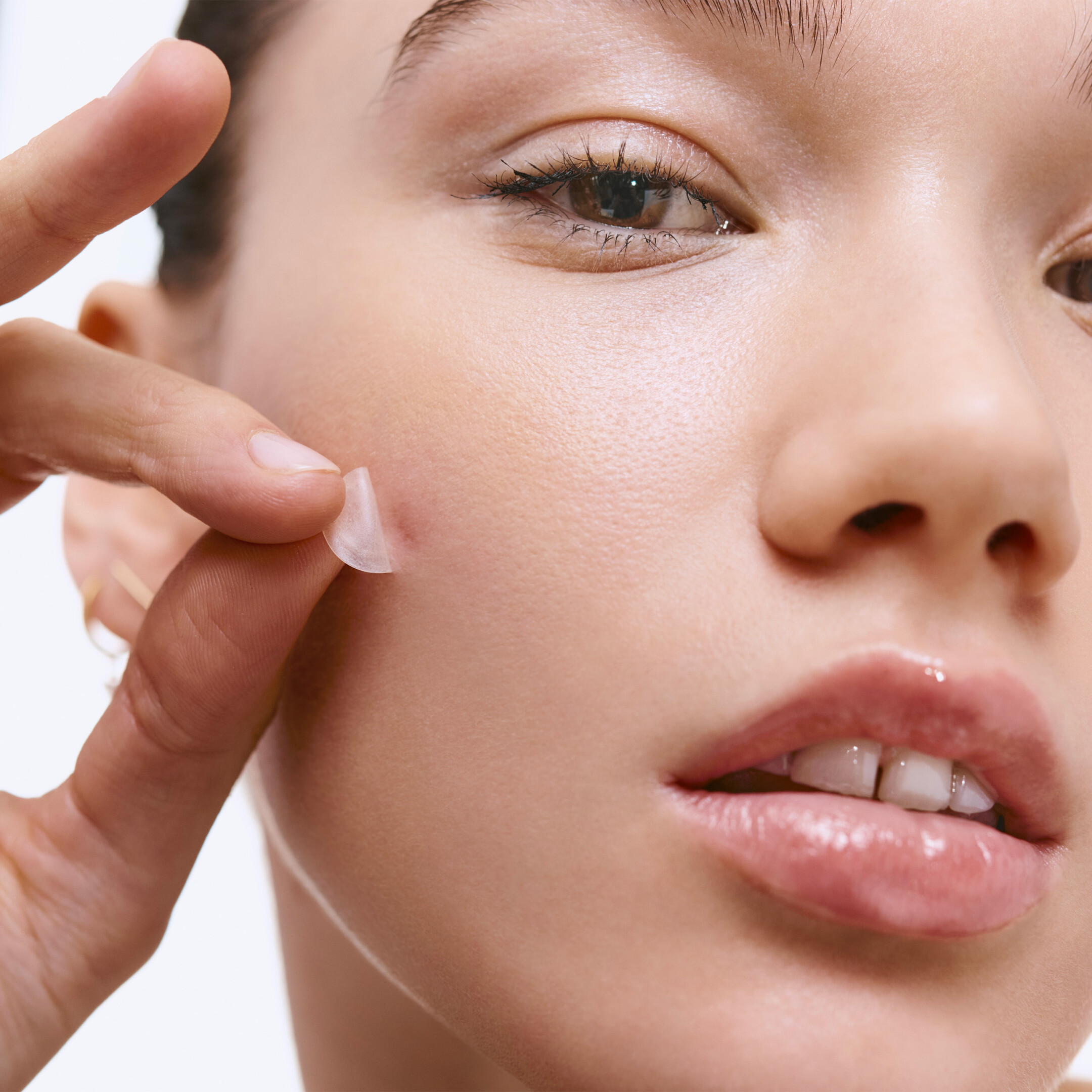 PIMPLE PATCHES - ΕΠΙΘΕΜΑΤΑ ΚΑΤΑ ΤΩΝ ΑΤΕΛΕΙΩΝ 5