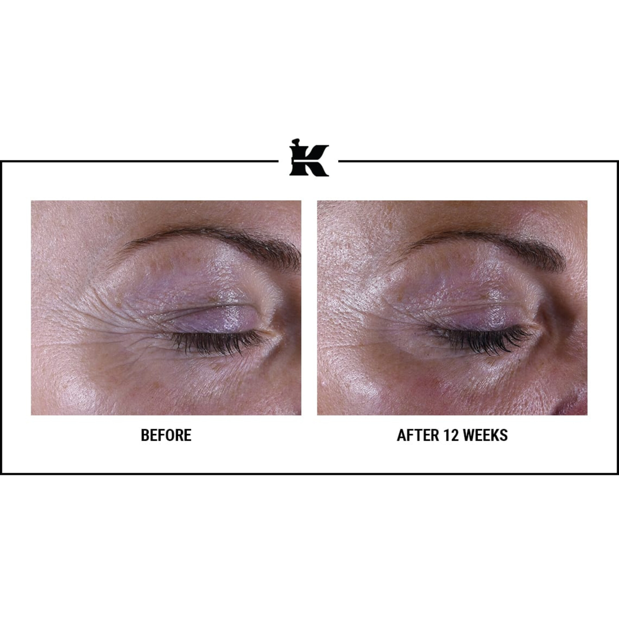 SUPER MULTI-CORRECTIVE EYE ZONE TREATMENT 7