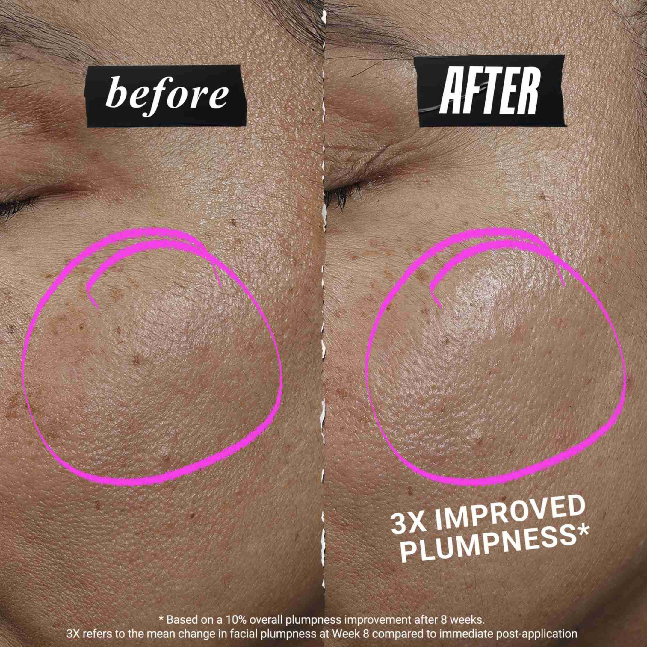 COLLASHOT PLUMP SERUM ΟΡΟΣ ΠΡΟΣΩΠΟΥ ΓΙΑ ΕΠΑΝΑΦΟΡΑ ΟΓΚΟΥ 2