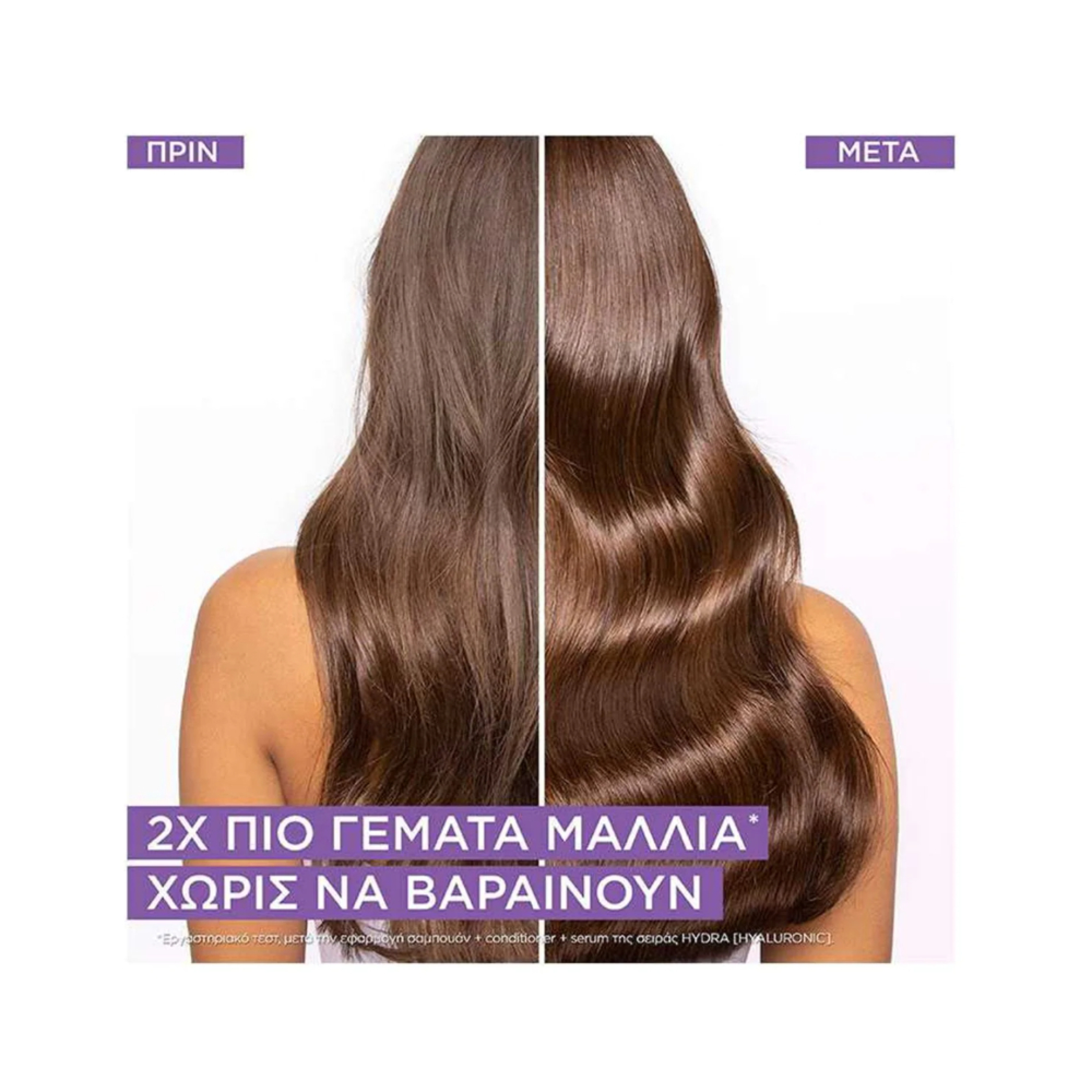 HYDRA HYALURONIC ΣΑΜΠΟΥΑΝ + CONDITIONER + SERUM ΓΙΑ ΑΦΥΔΑΤΩΜΕΝΑ ΜΑΛΛΙΑ 1