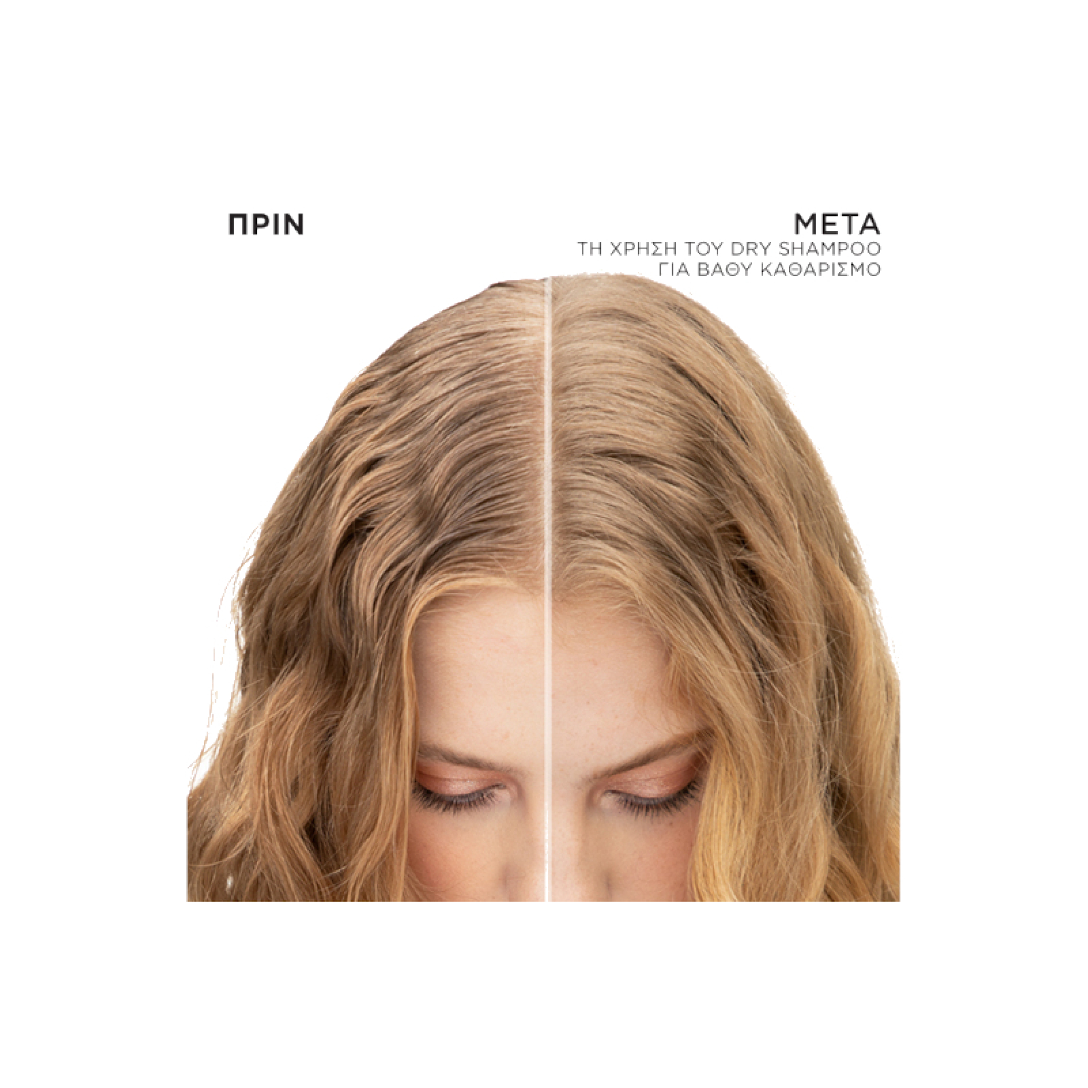 REDKEN DRY SHAMPOO ΓΙΑ ΒΑΘΥ ΚΑΘΑΡΙΣΜΟ 3