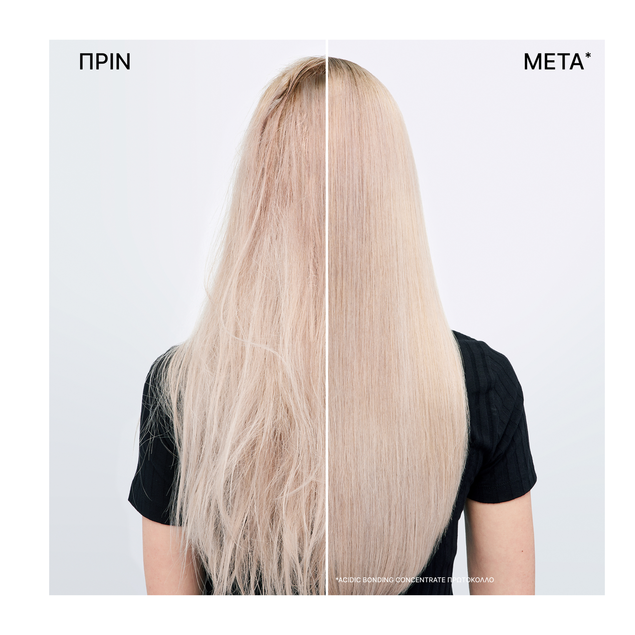 ACIDIC BONDING CONCENTRATE GIFT SET ΓΙΑ ΕΝΤΑΤΙΚΗ ΑΝΑΔΟΜΗΣΗ ΣΤΑ ΤΑΛΑΙΠΩΡΗΜΕΝΑ ΜΑΛΛΙΑ 1