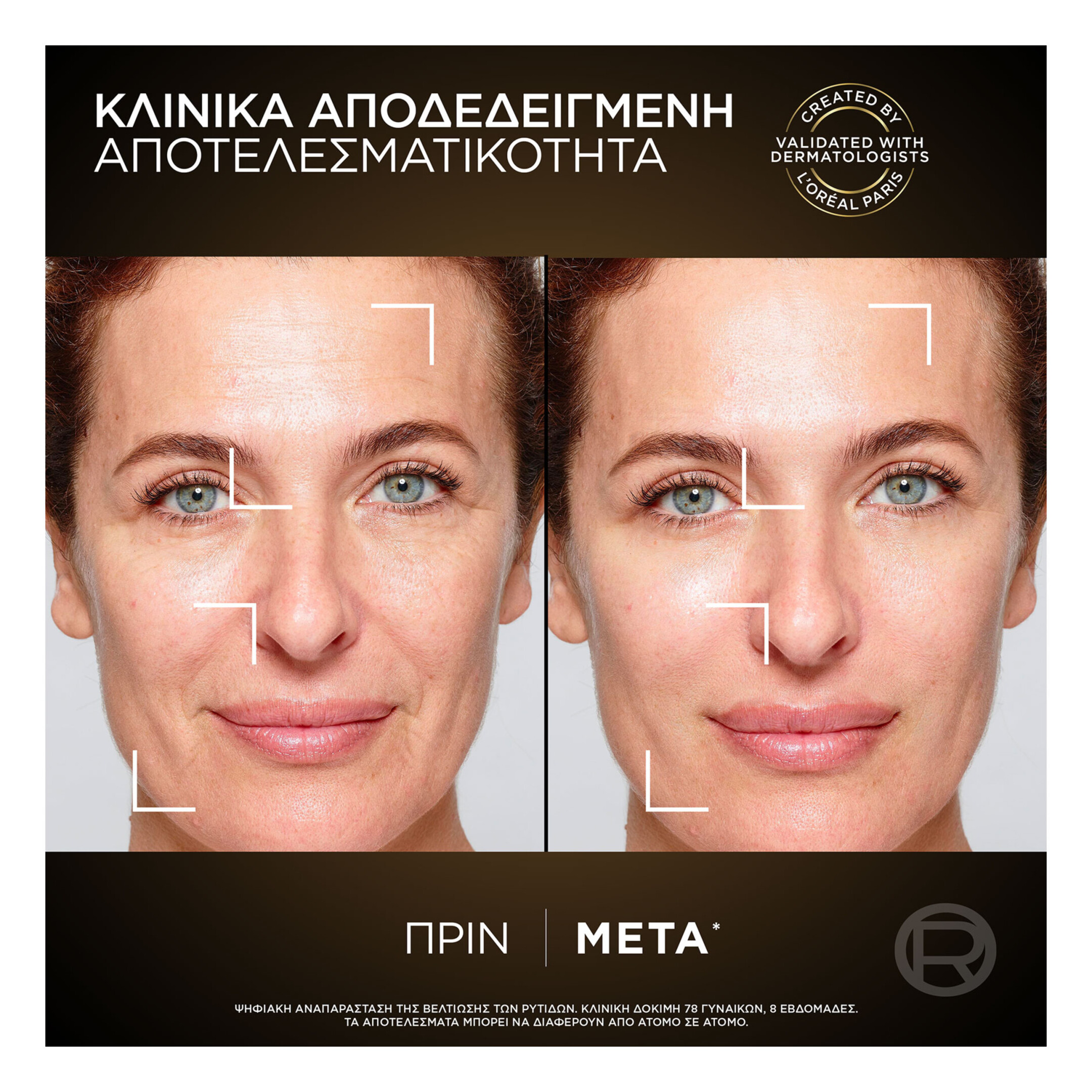 AGE PERFECT ΚΥΤΤΑΡΙΚΗ ΑΝΑΠΛΑΣΗ ΚΡΕΜΑ ΝΥΚΤΟΣ MIDNIGHT 3
