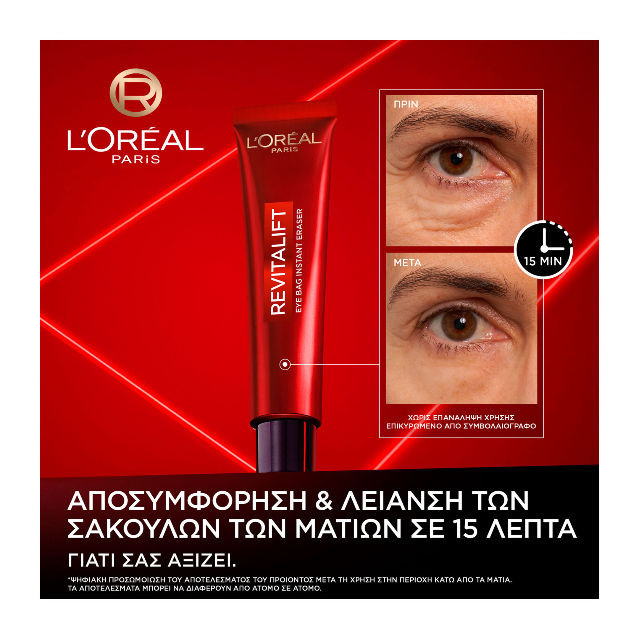 REVITALIFT LASER ΚΡΕΜΑ ΜΑΤΙΩΝ ΗΜΕΡΑΣ EYE BAG ERASER 3