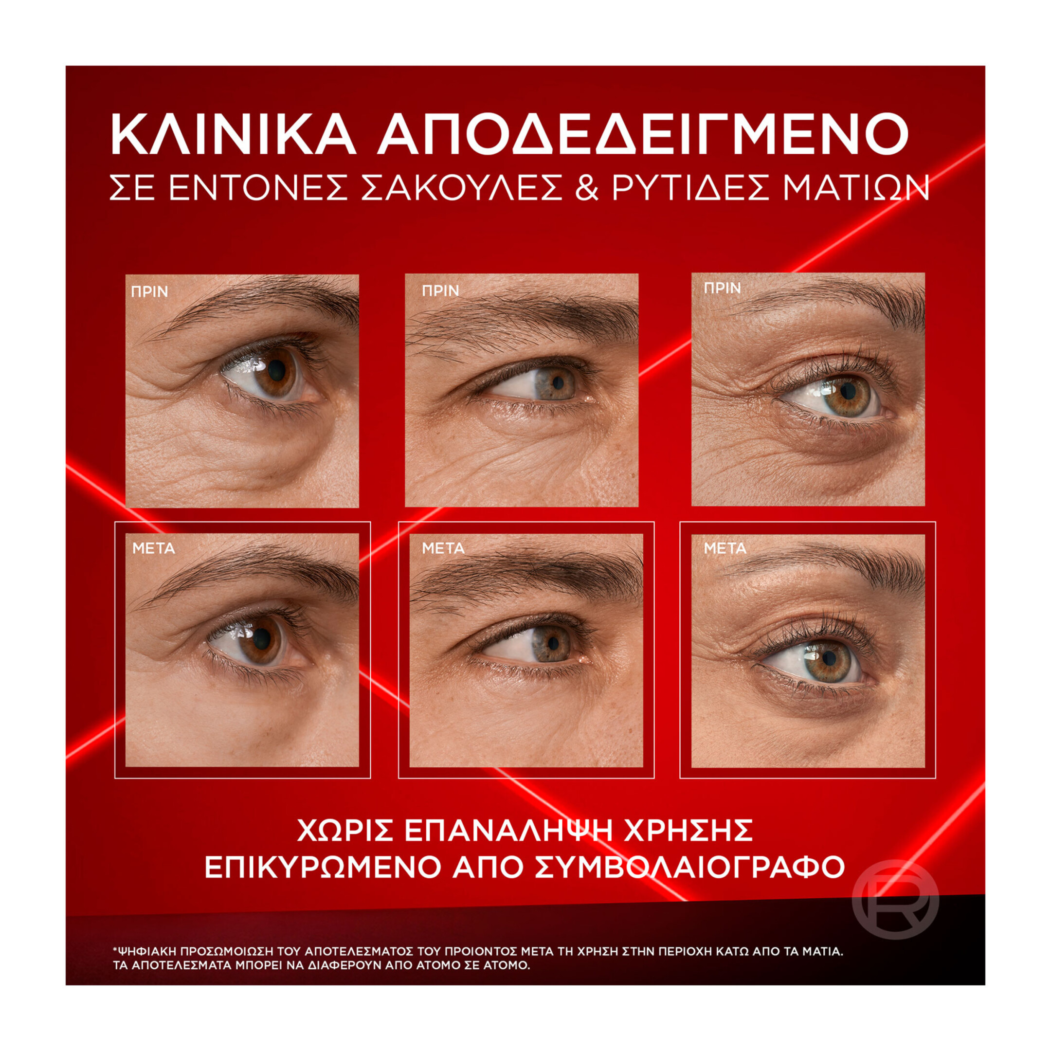 REVITALIFT LASER ΚΡΕΜΑ ΜΑΤΙΩΝ ΗΜΕΡΑΣ EYE BAG ERASER 7