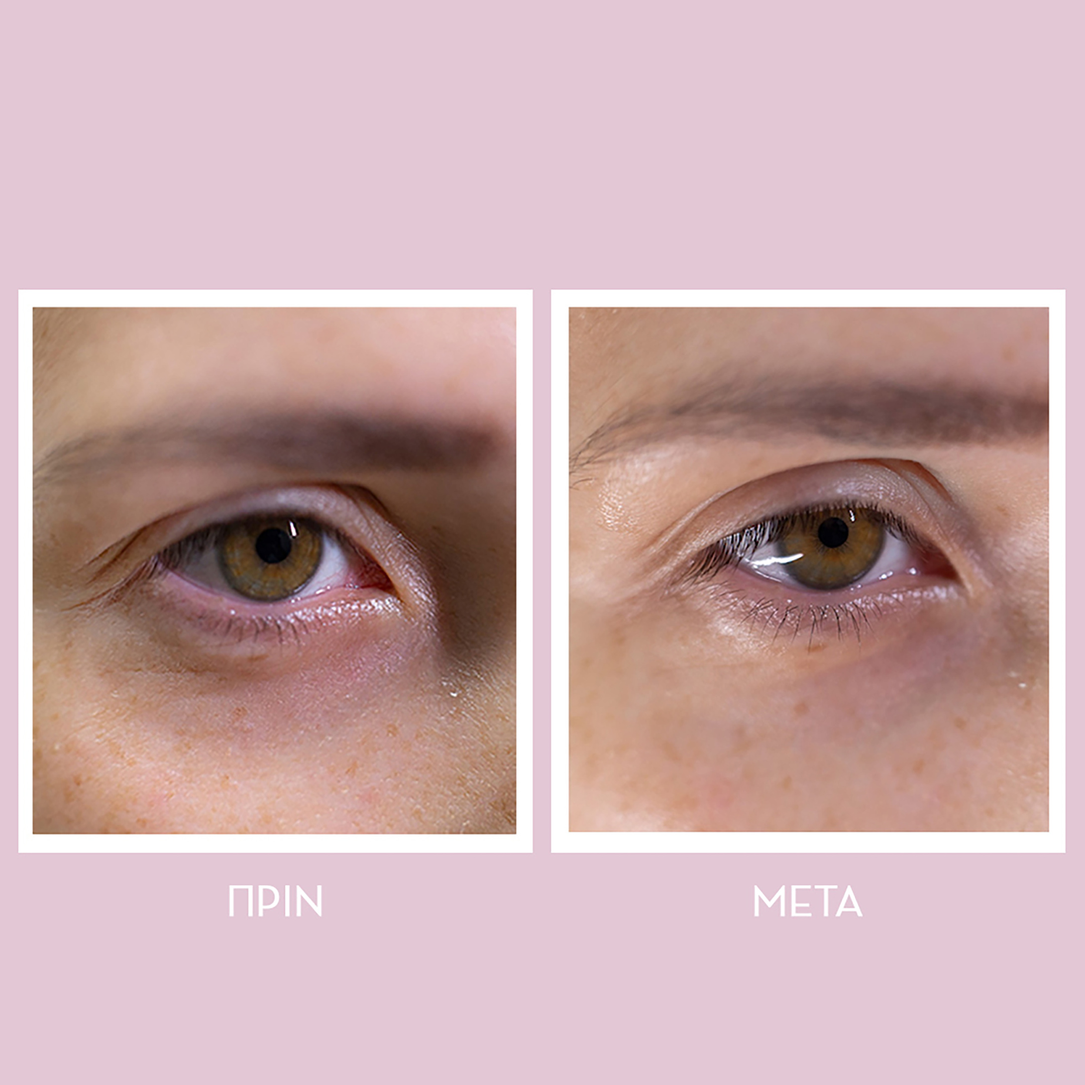 PEPTIDES SPRING HYDRA-GEL EYE PATCHES_30 PAIRS 6
