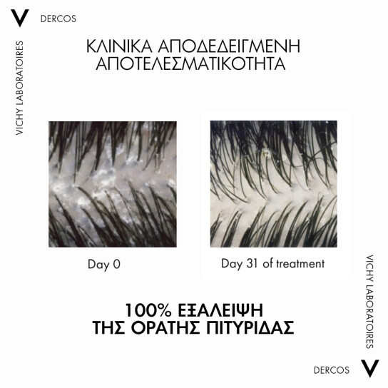 DERCOS ANTI-DANDRUFF DS 2ΣΕ1 ΣΑΜΠΟΥΑΝ & CONDITIONER ΚΑΤΑ ΤΗΣ ΞΗΡΟΔΕΡΜΙΑΣ, ΤΗΣ ΠΙΤΥΡΙΔΑΣ ΚΑΙ ΤΟΥ ΚΝΗΣΜΟΥ 6