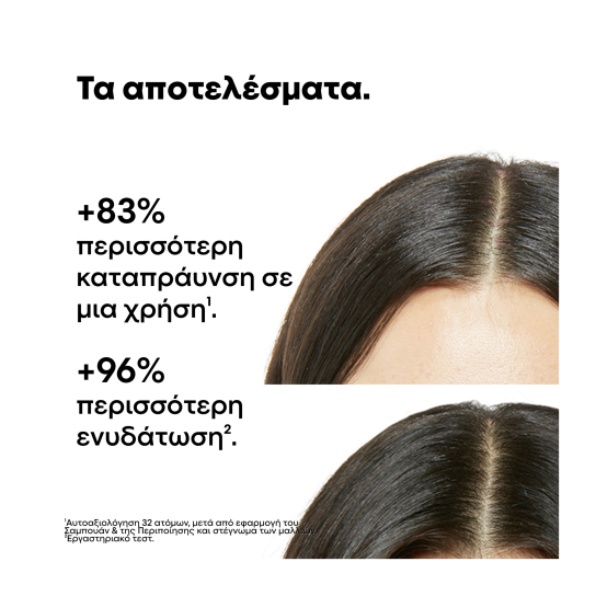 SCALP ADVANCED GIFT SET ΓΙΑ ΤΟ ΕΥΑΙΣΘΗΤΟ ΤΡΙΧΩΤΟ ΚΕΦΑΛΗΣ 4