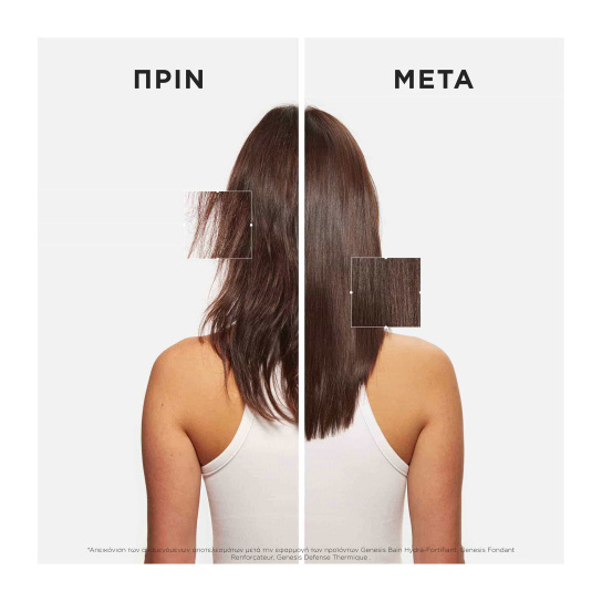 GENESIS ΣΕΤ ΠΕΡΙΠΟΙΗΣΗΣ ΓΙΑ ΑΔΥΝΑΜΑ ΜΑΛΛΙΑ ΜΕ ΤΑΣΗ ΤΡΙΧΟΠΤΩΣΗΣ 4