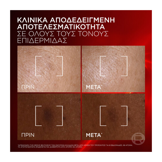 REVITALIFT TRIPLE LASER SERUM ΑΝΤΙΓΗΡΑΝΤΙΚΟΣ ΚΡΕΜΩΔΗΣ ΟΡΟΣ 7