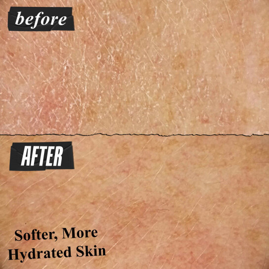 ULTRA FACIAL ΕΝΥΔΑΤΙΚΗ ΚΡΕΜΑ ΠΡΟΣΩΠΟΥ 2