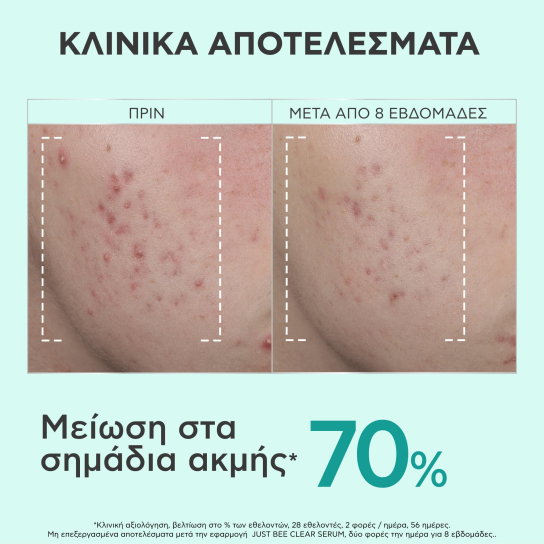 JUST BEE CLEAR SERUM 4