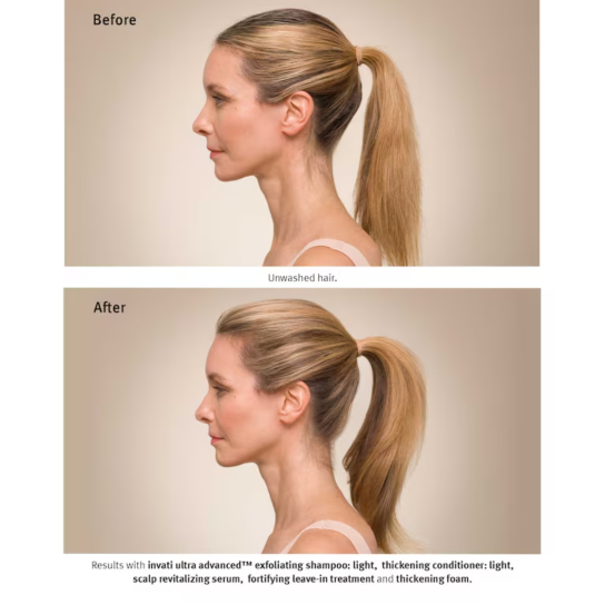 INVATI ULTRA ADVANCED FOAM  3