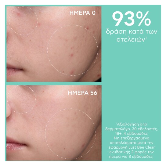 JUST BEE CLEAR ΣΕΤ ΚΑΤΑ ΤΩΝ ΑΤΕΛΕΙΩΝ ΕΝΥΔΑΤΩΣΗ & ΜΑΤ ΑΠΟΤΕΛΕΣΜΑ  5