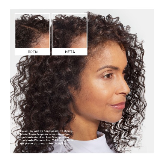 ANTI-HAIR LOSS ΣΑΜΠΟΥΑΝ ΚΑΤΑ ΤΗΣ ΤΡΙΧΟΠΤΩΣΗΣ 5